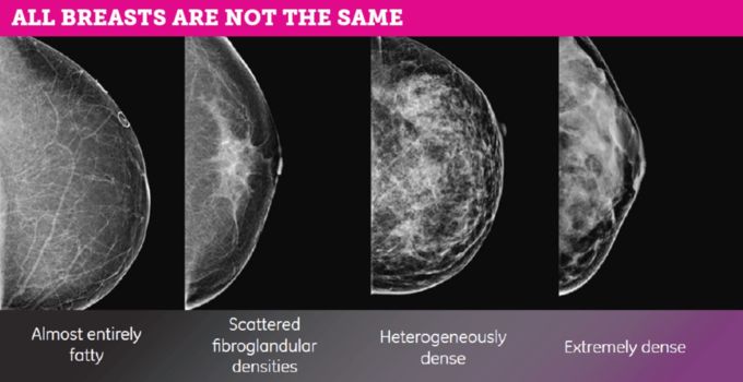 Breast-scan