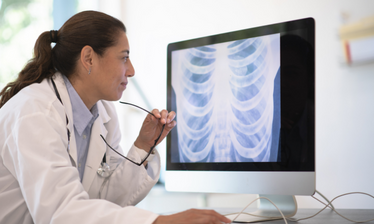 women looking at chest xray